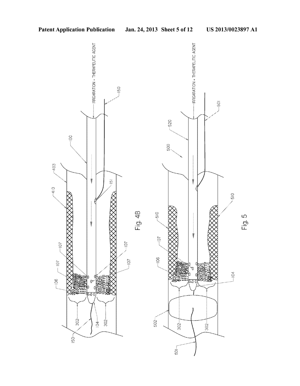 Devices and Methods for Endovascular Therapies - diagram, schematic, and image 06