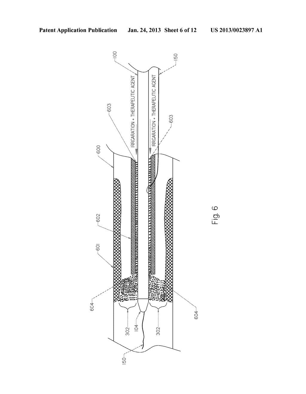 Devices and Methods for Endovascular Therapies - diagram, schematic, and image 07