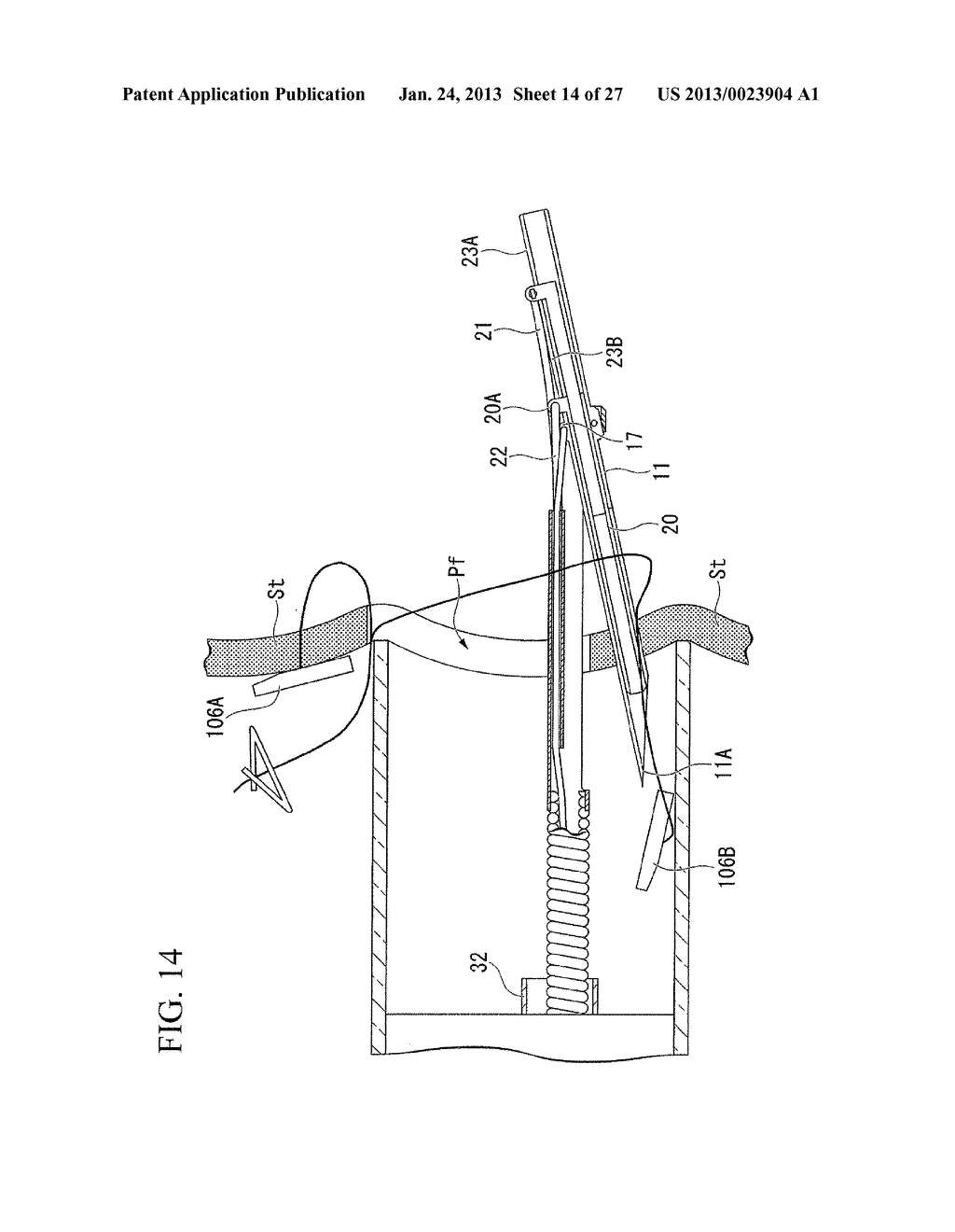 Suturing method - diagram, schematic, and image 15