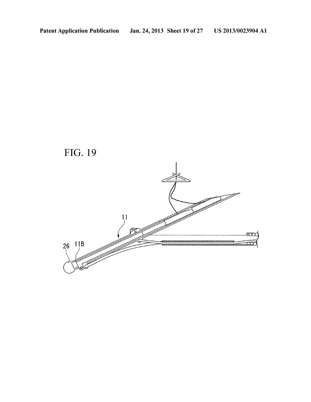 Suturing method - diagram, schematic, and image 20