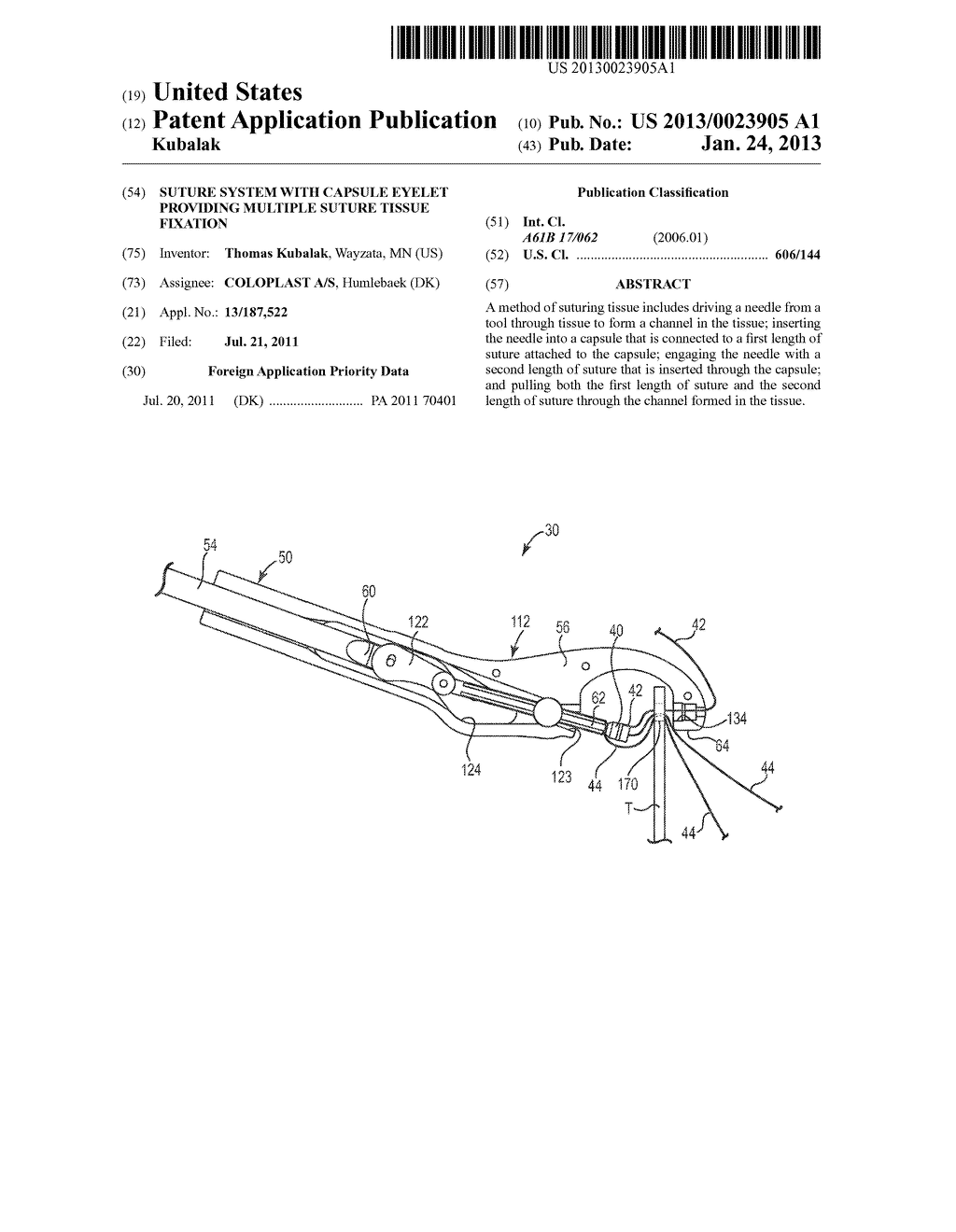 SUTURE SYSTEM WITH CAPSULE EYELET PROVIDING MULTIPLE SUTURE TISSUE     FIXATION - diagram, schematic, and image 01