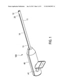 SUTURE TENSIONING DEVICE diagram and image