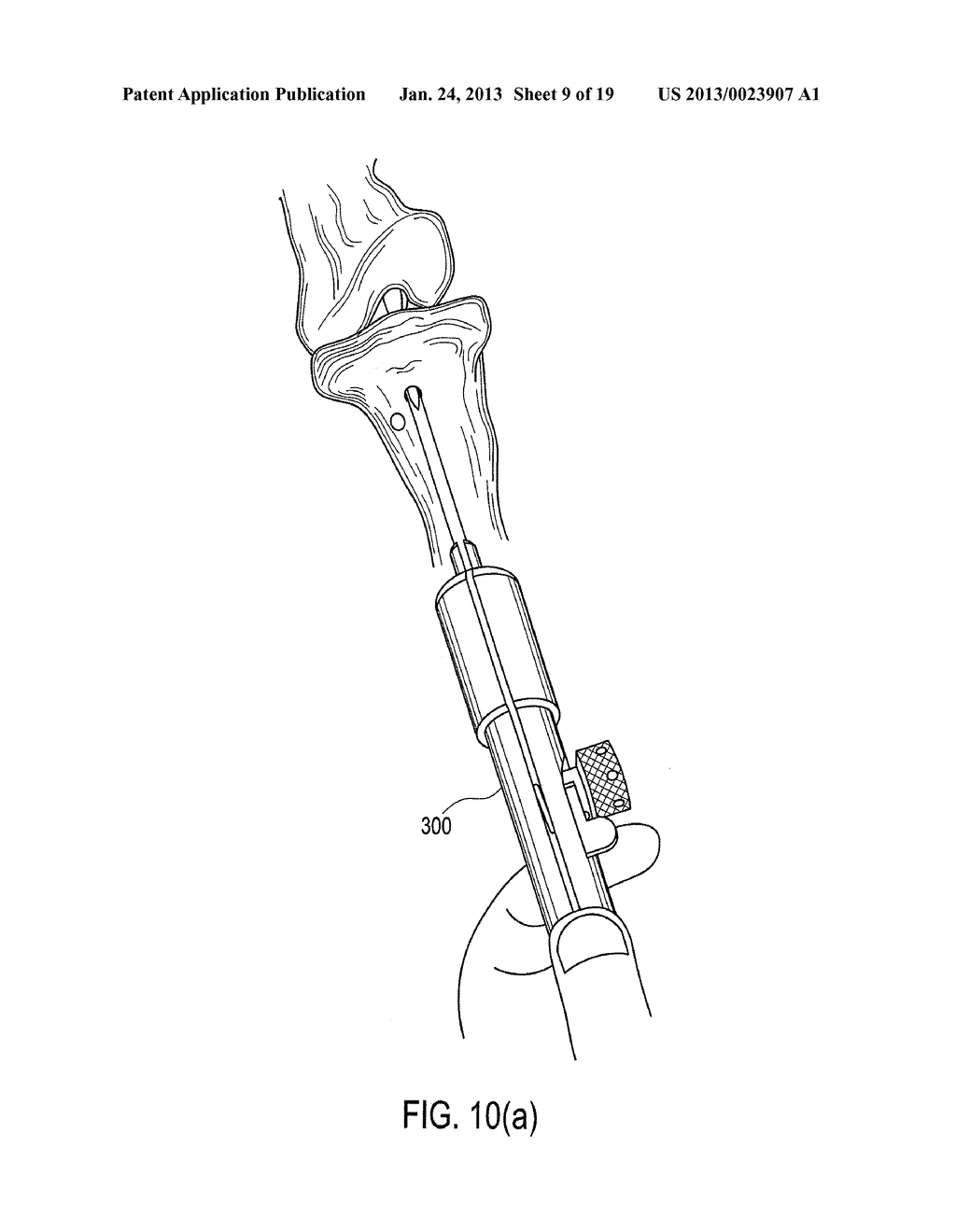 SUTURE TENSIONING DEVICE - diagram, schematic, and image 10