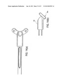 SUTURE TENSIONING DEVICE diagram and image