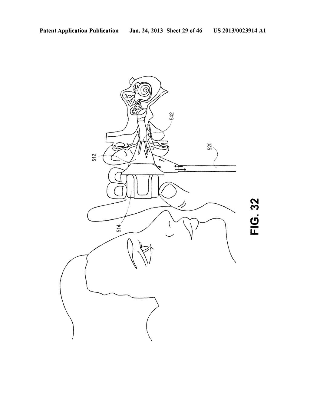 SYSTEM FOR ACCESSING BODY ORIFICE AND METHOD - diagram, schematic, and image 30