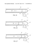 TISSUE REMOVAL DEVICE FOR NEUROSURGICAL AND SPINAL SURGERY APPLICATIONS diagram and image