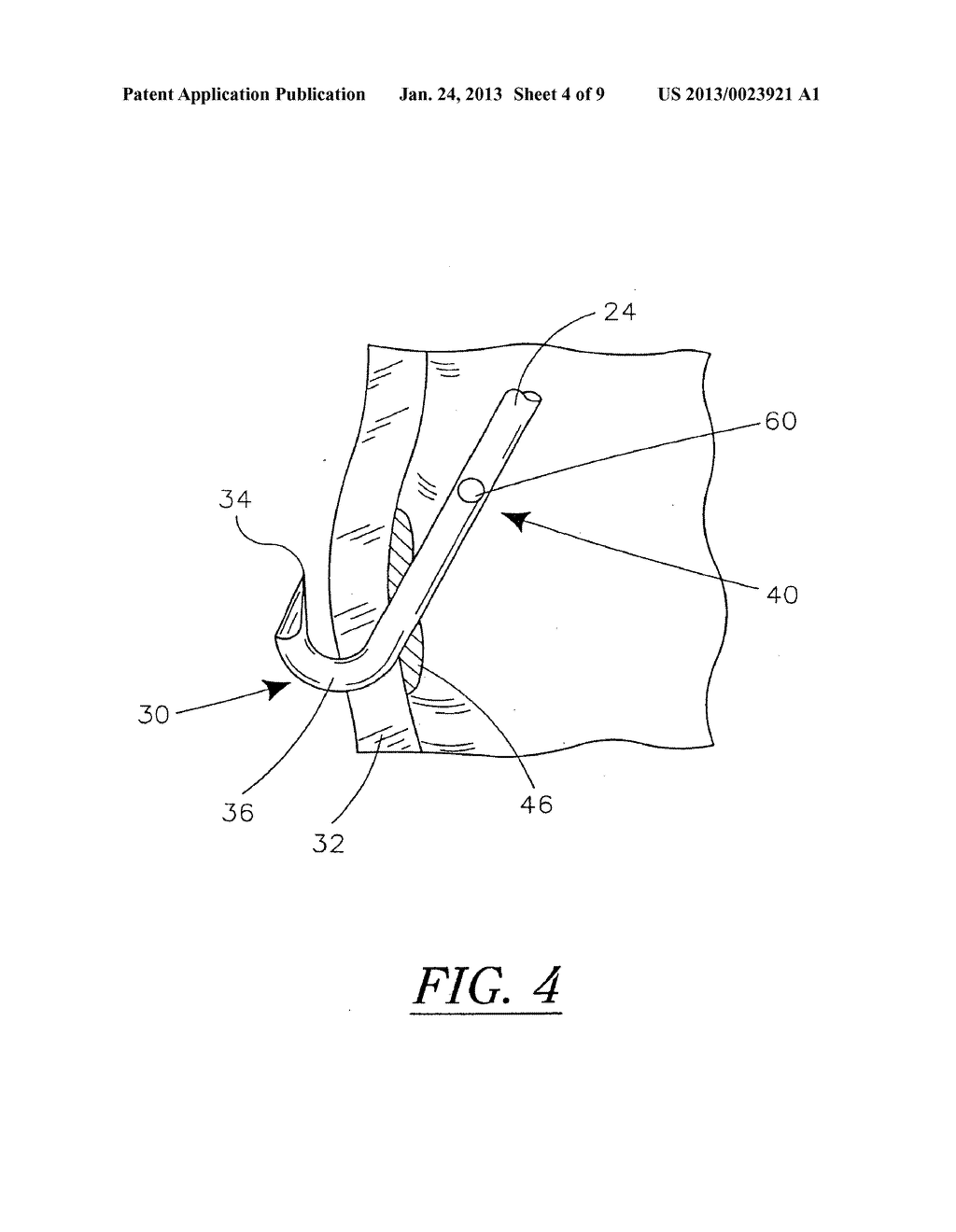 THROMBUS FILTER WITH BREAK-AWAY ANCHOR MEMBERS - diagram, schematic, and image 05