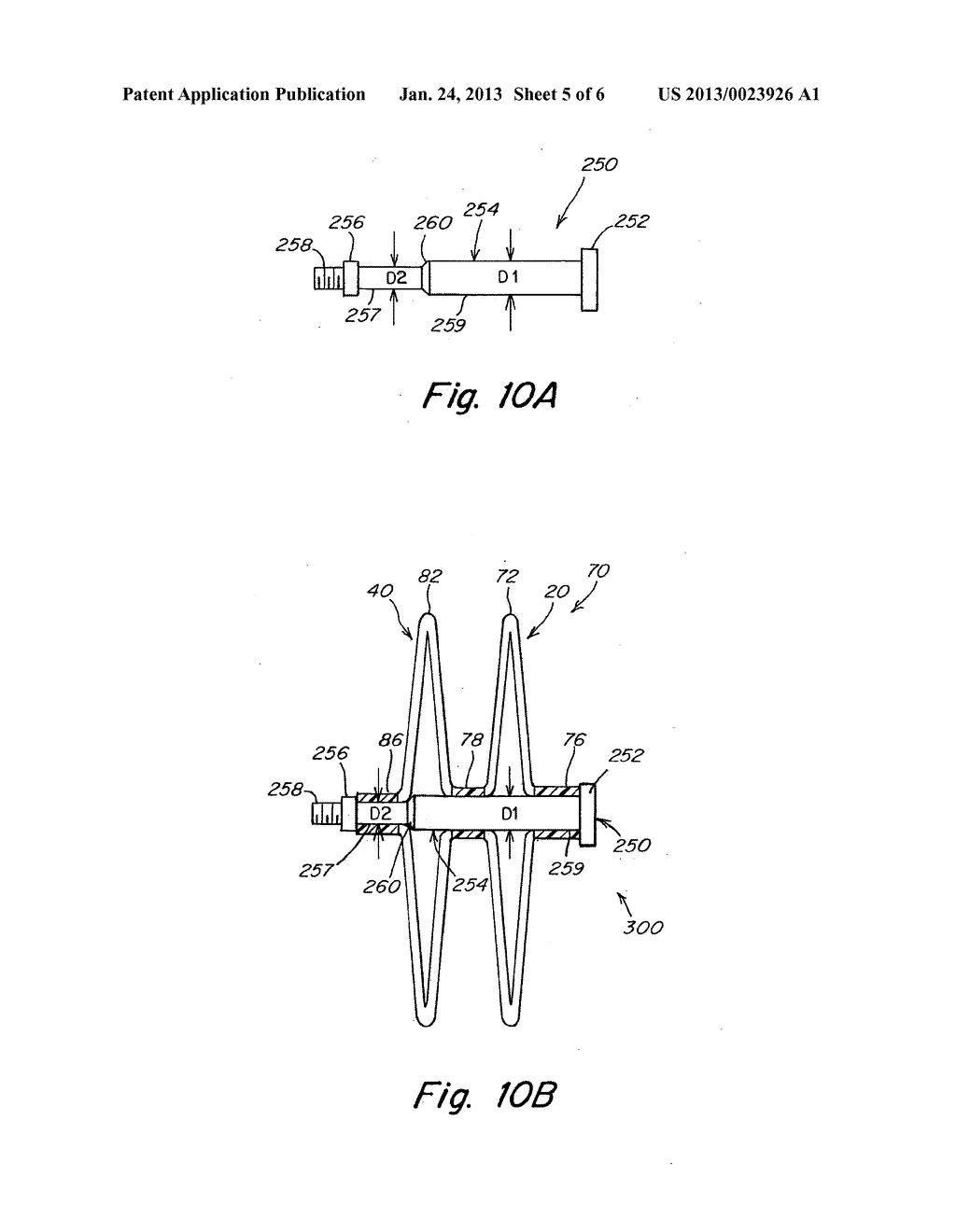 Catch Member for PFO Occluder - diagram, schematic, and image 06