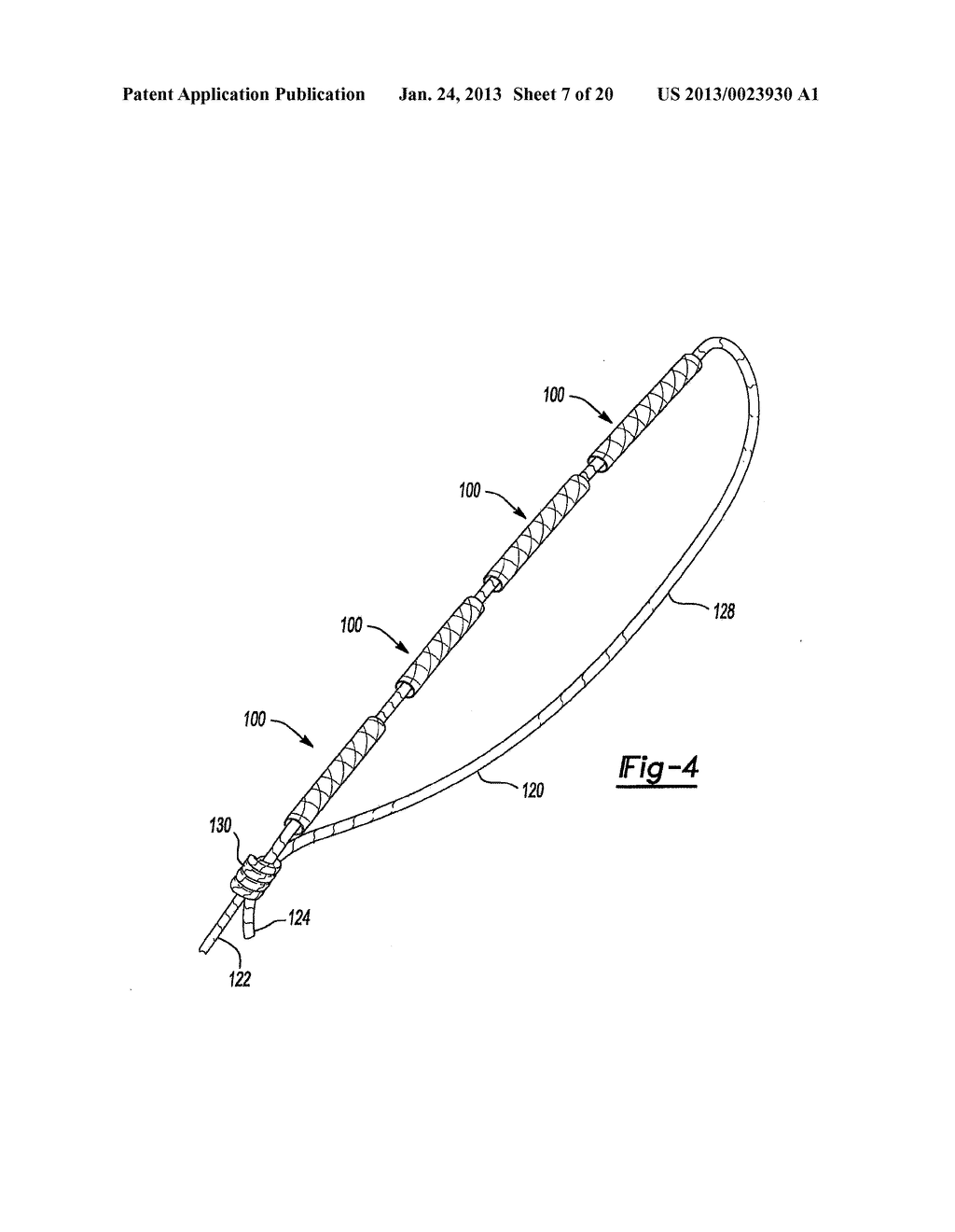 Method for Tissue Fixation - diagram, schematic, and image 08