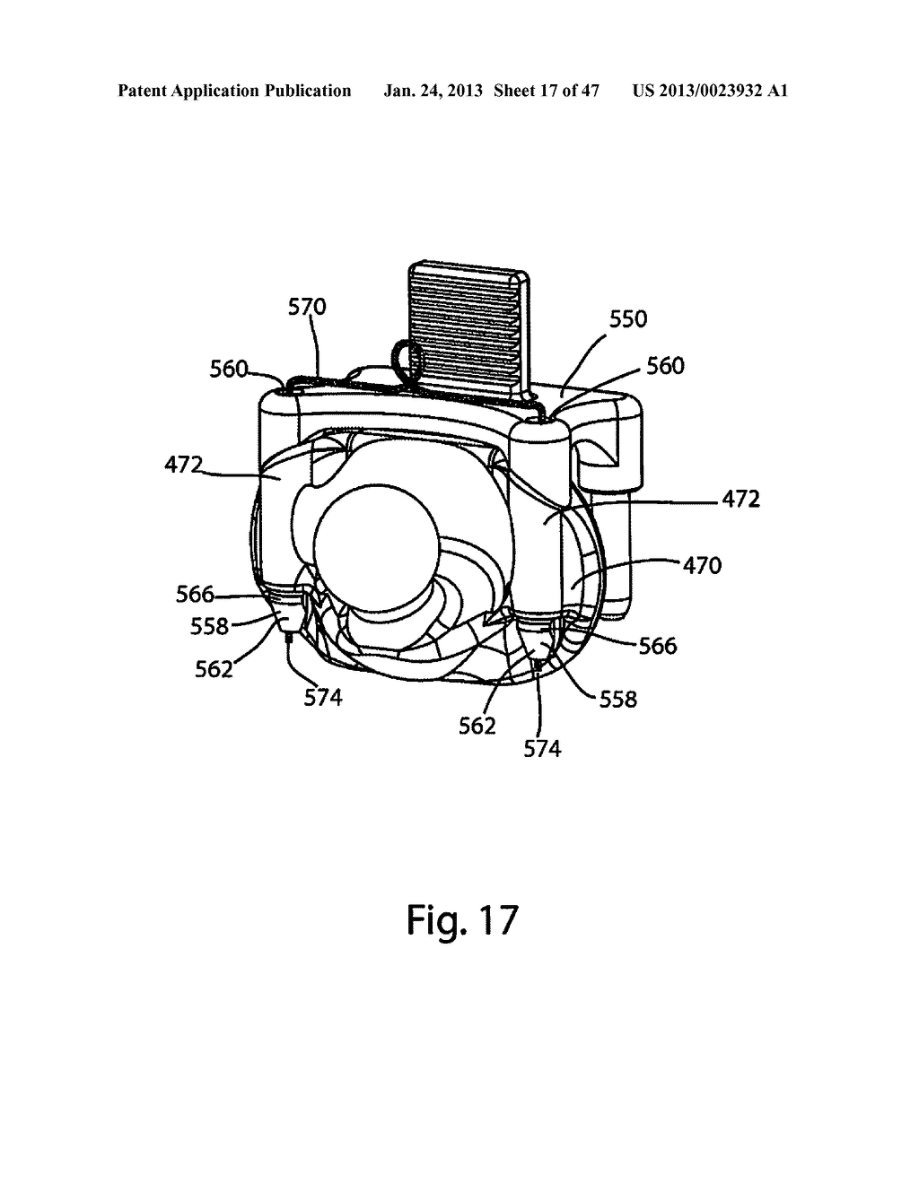 System and Method for Facet Hoint Replacement - diagram, schematic, and image 18