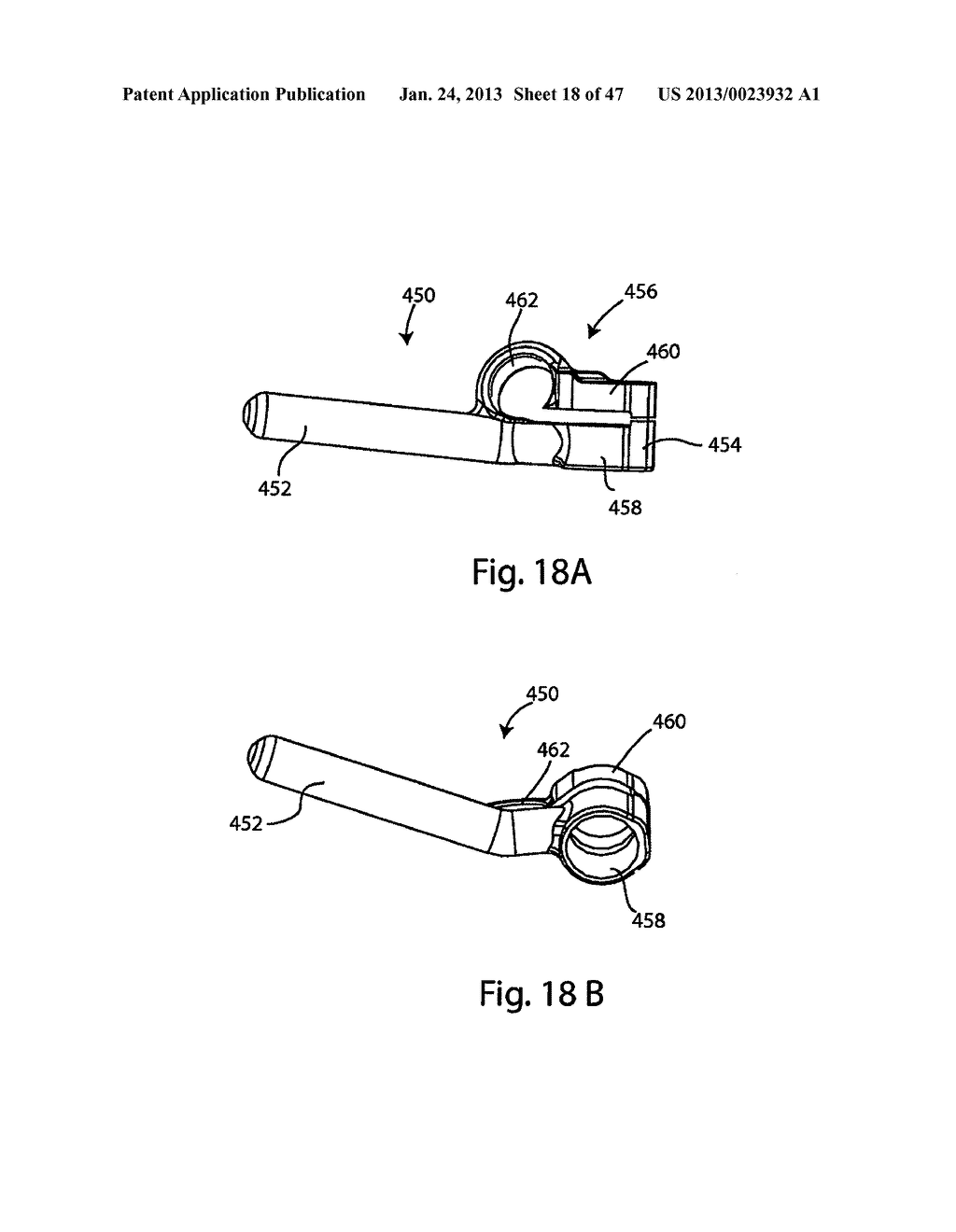 System and Method for Facet Hoint Replacement - diagram, schematic, and image 19