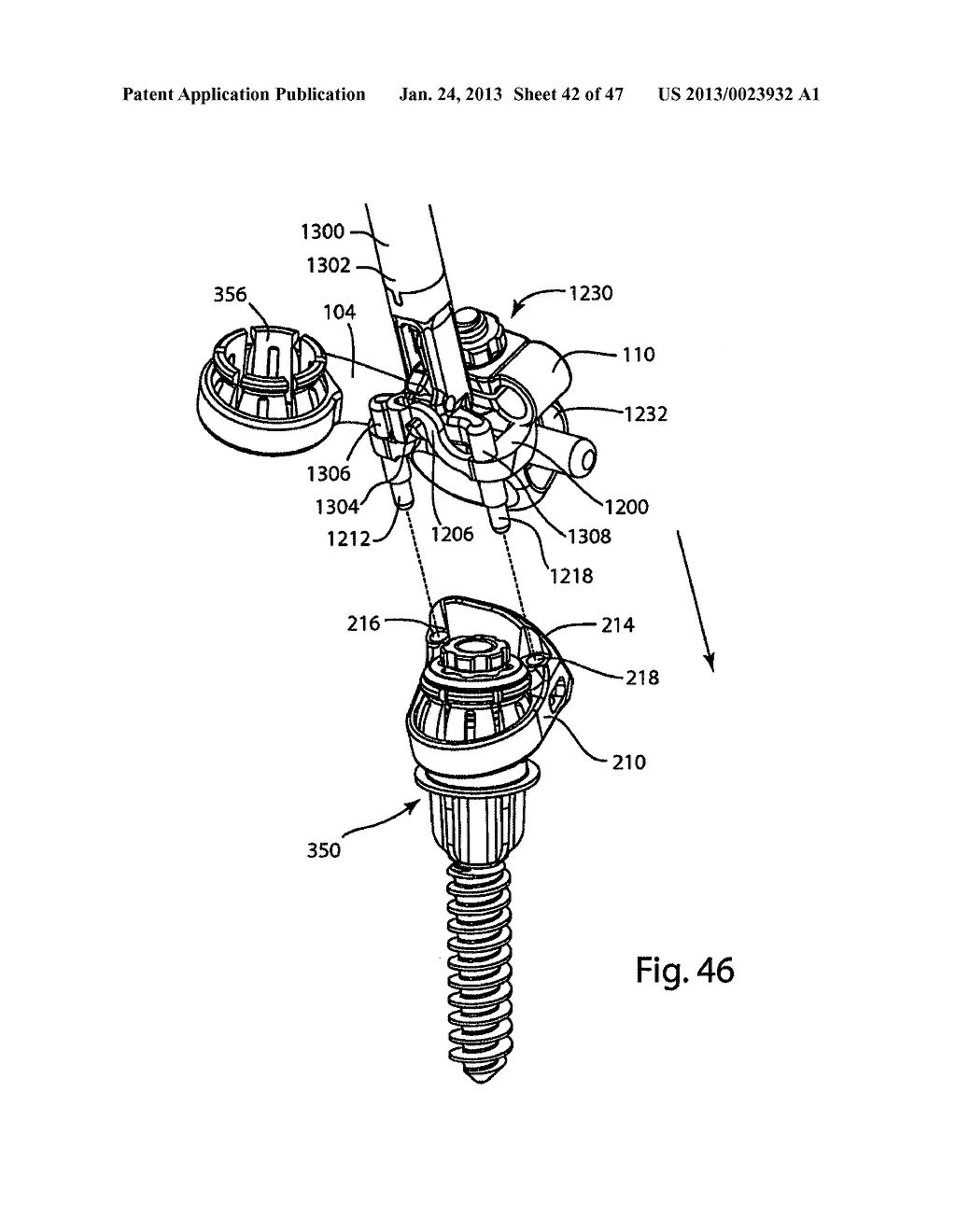 System and Method for Facet Hoint Replacement - diagram, schematic, and image 43