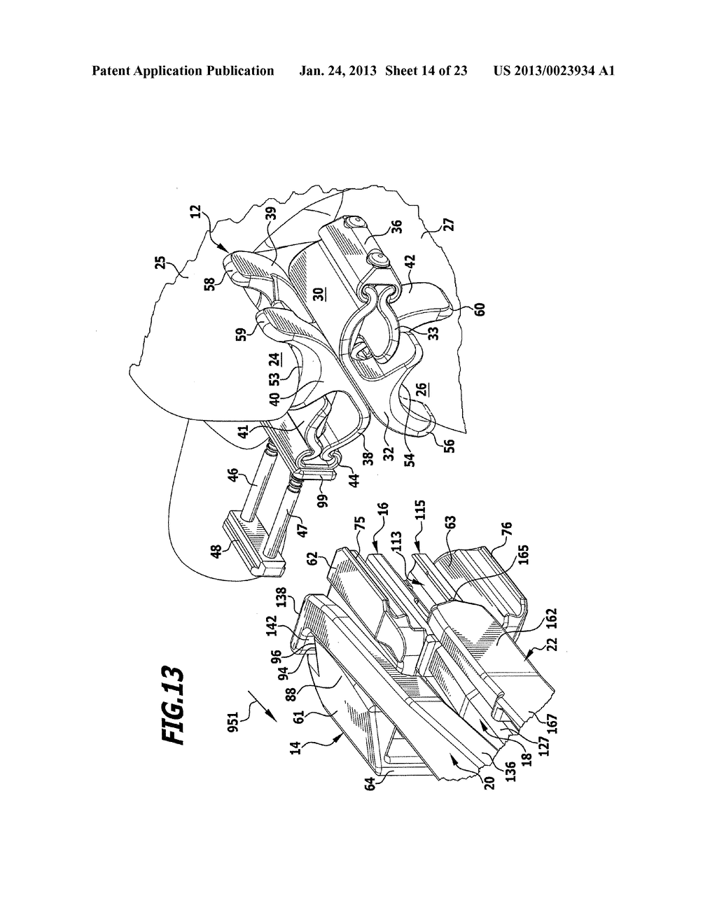 SURGICAL APPARATUS - diagram, schematic, and image 15