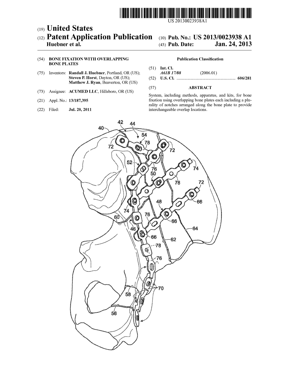 BONE FIXATION WITH OVERLAPPING BONE PLATES - diagram, schematic, and image 01