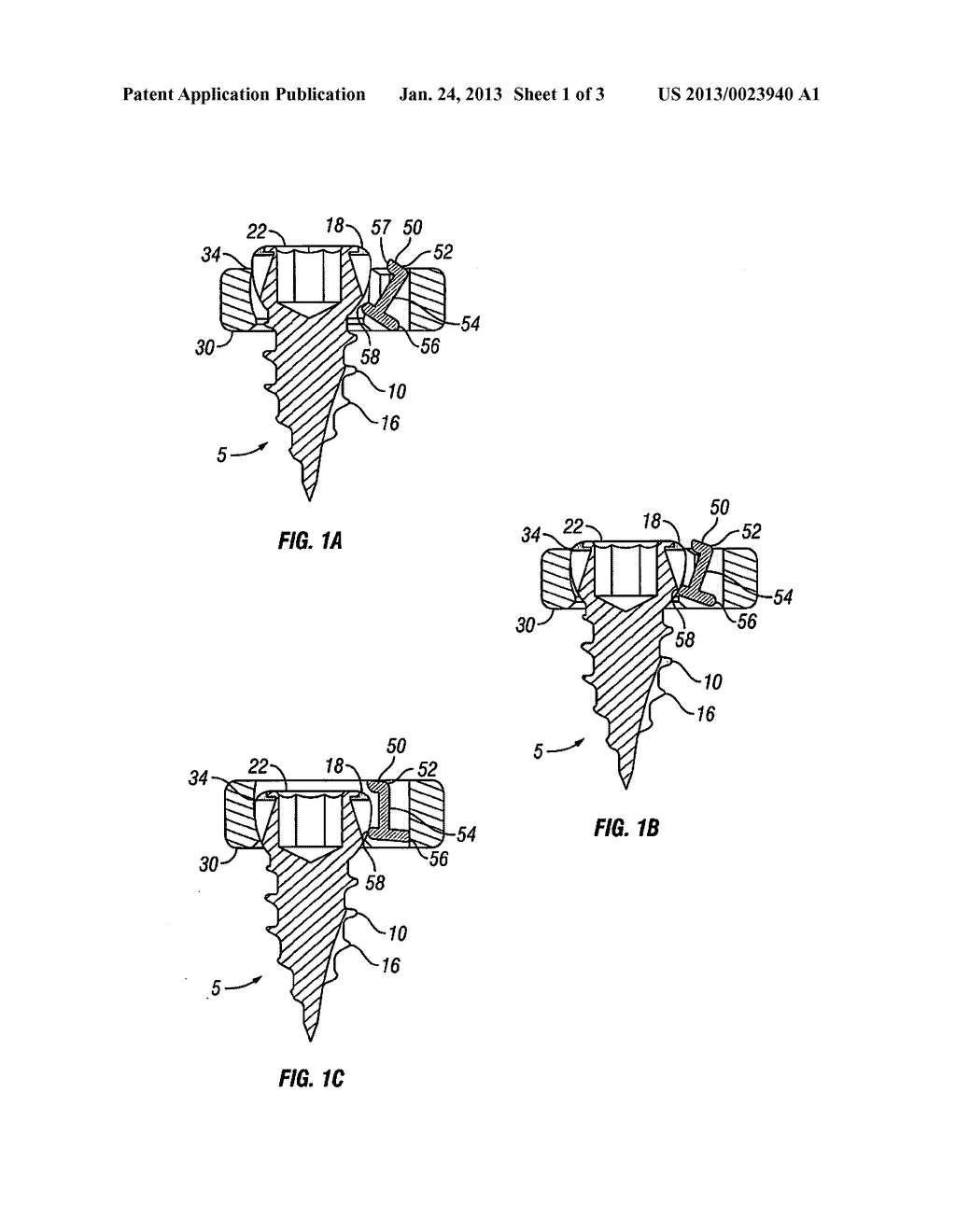 Locking Confirmation Mechanism For a Bone Screw and Plate Assembly - diagram, schematic, and image 02