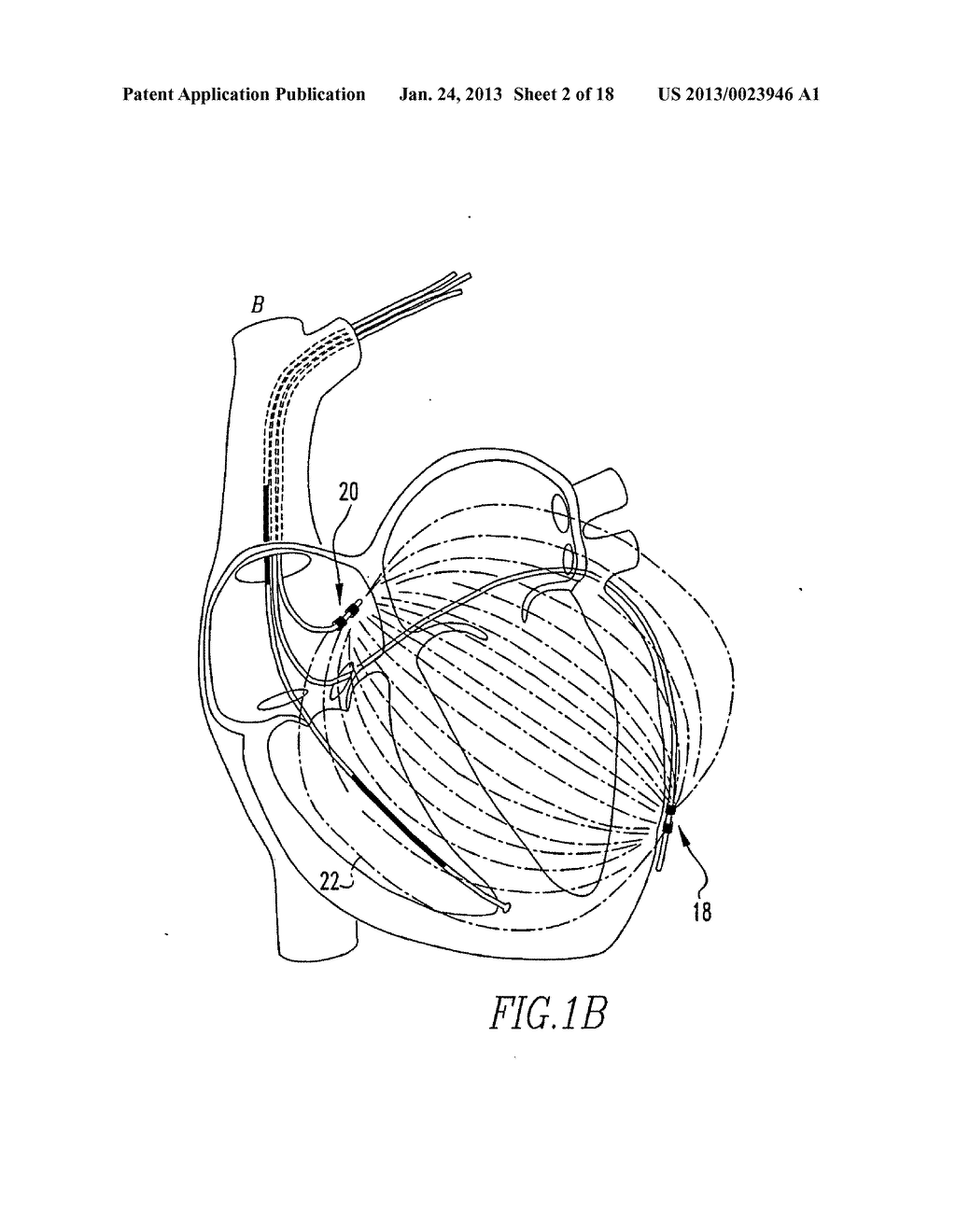 Low Power Apparatus and Method to Measure Complex Electrical Admittance or     Impedance - diagram, schematic, and image 03