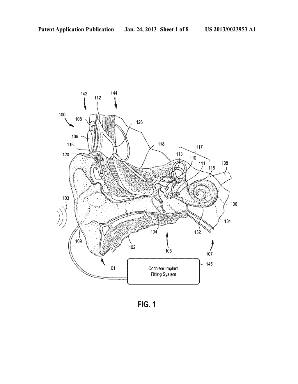 Systems, Methods, and Articles of Manufacture for Characterizing Hearing     Prosthesis Channel Interaction - diagram, schematic, and image 02