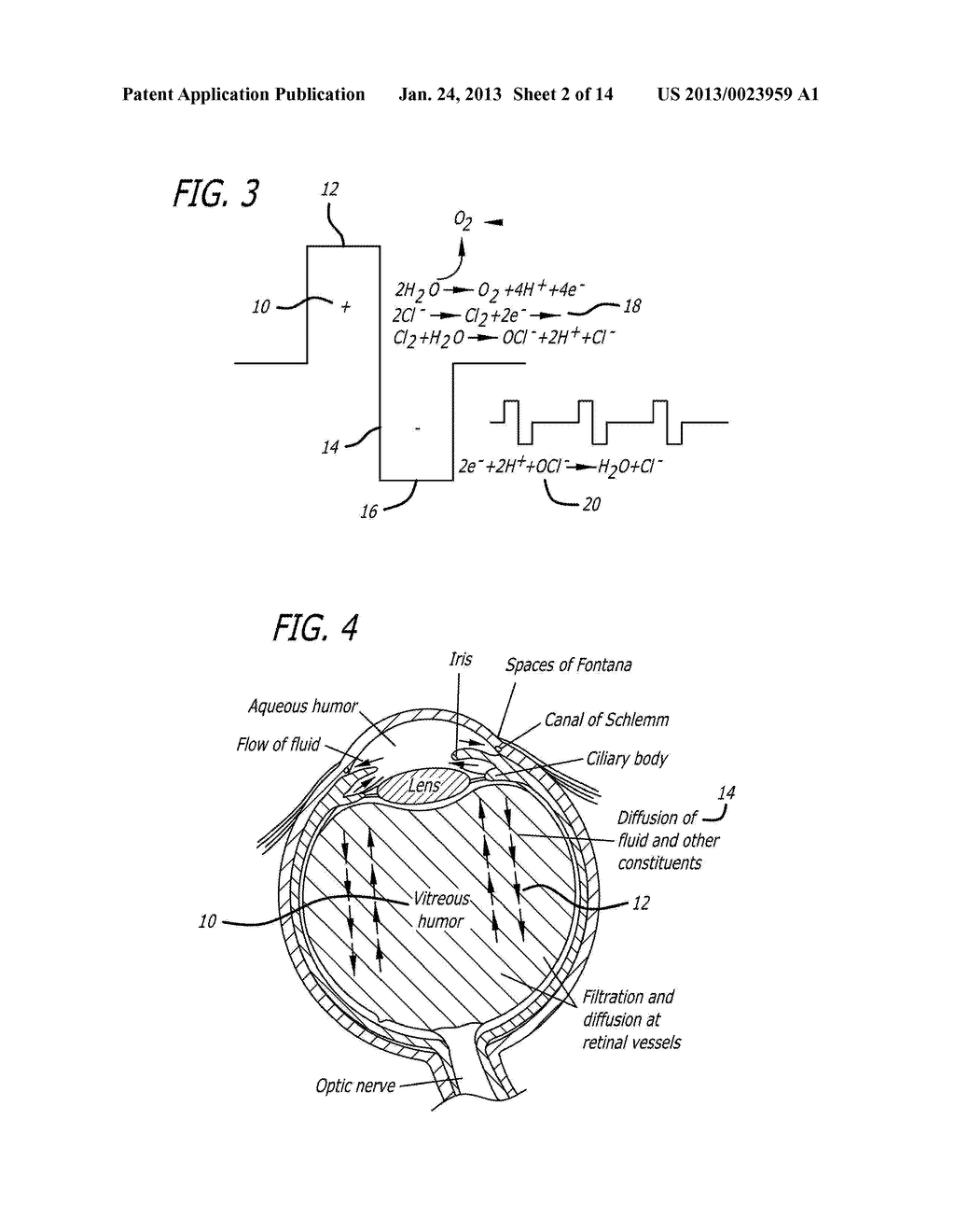 METHOD AND APPARATUS FOR TREATING ISCHEMIC DISEASES - diagram, schematic, and image 03