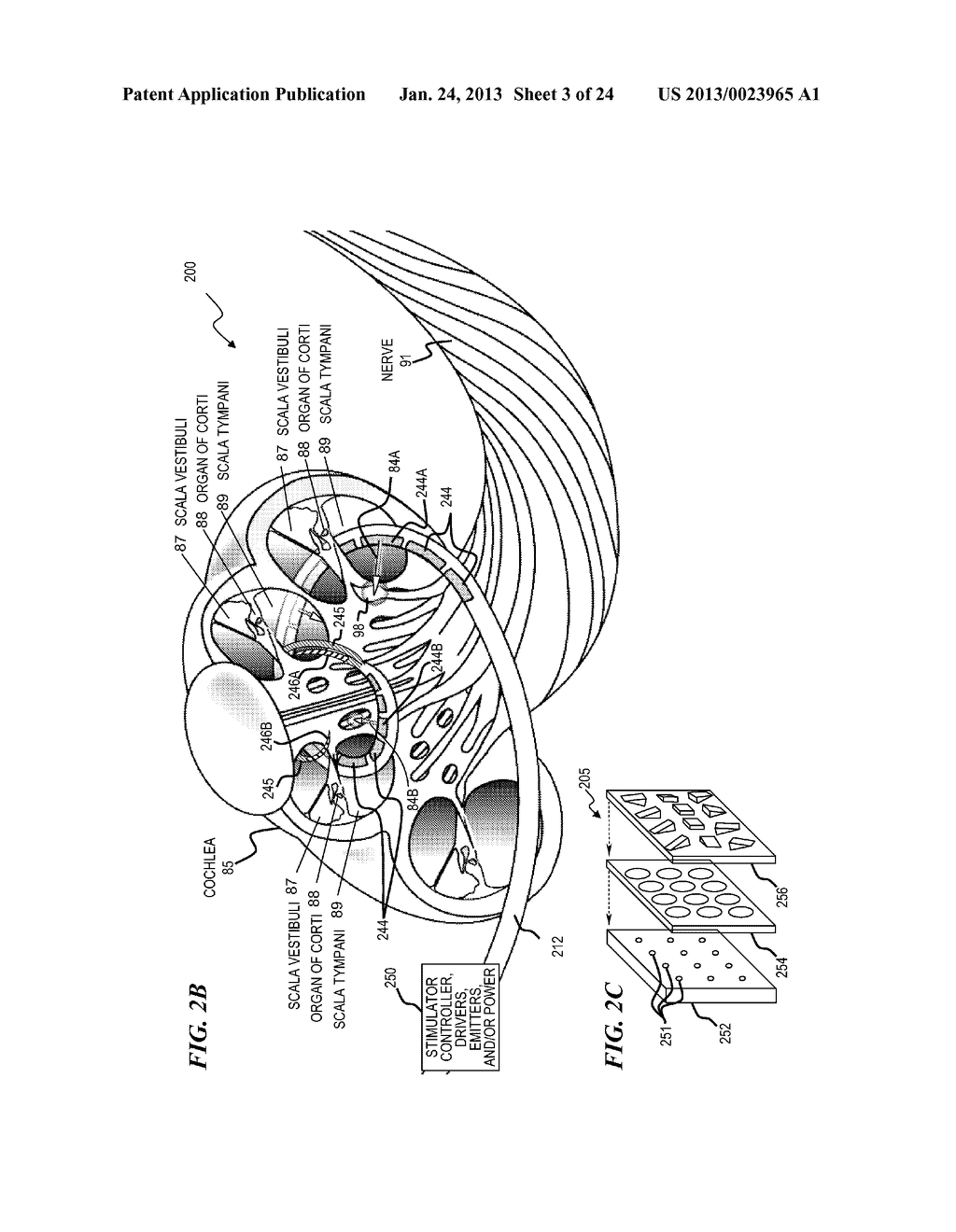 OPTIMIZED STIMULATION RATE OF AN OPTICALLY STIMULATING COCHLEAR IMPLANT - diagram, schematic, and image 04