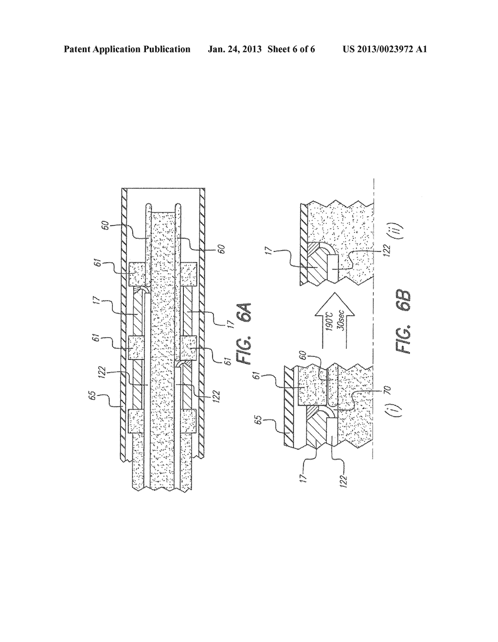 ELECTRODE ARRAY ASSEMBLY AND METHOD OF MAKING SAME - diagram, schematic, and image 07