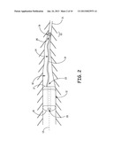 INTRAVASCULAR MEDICAL DEVICE WITH ADVANCABLE ELECTRODE diagram and image