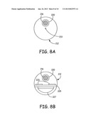 INTRAVASCULAR MEDICAL DEVICE WITH ADVANCABLE ELECTRODE diagram and image