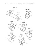 OSTIAL STENTING SYSTEM diagram and image