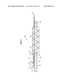 OSTIAL STENTING SYSTEM diagram and image