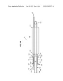 OSTIAL STENTING SYSTEM diagram and image