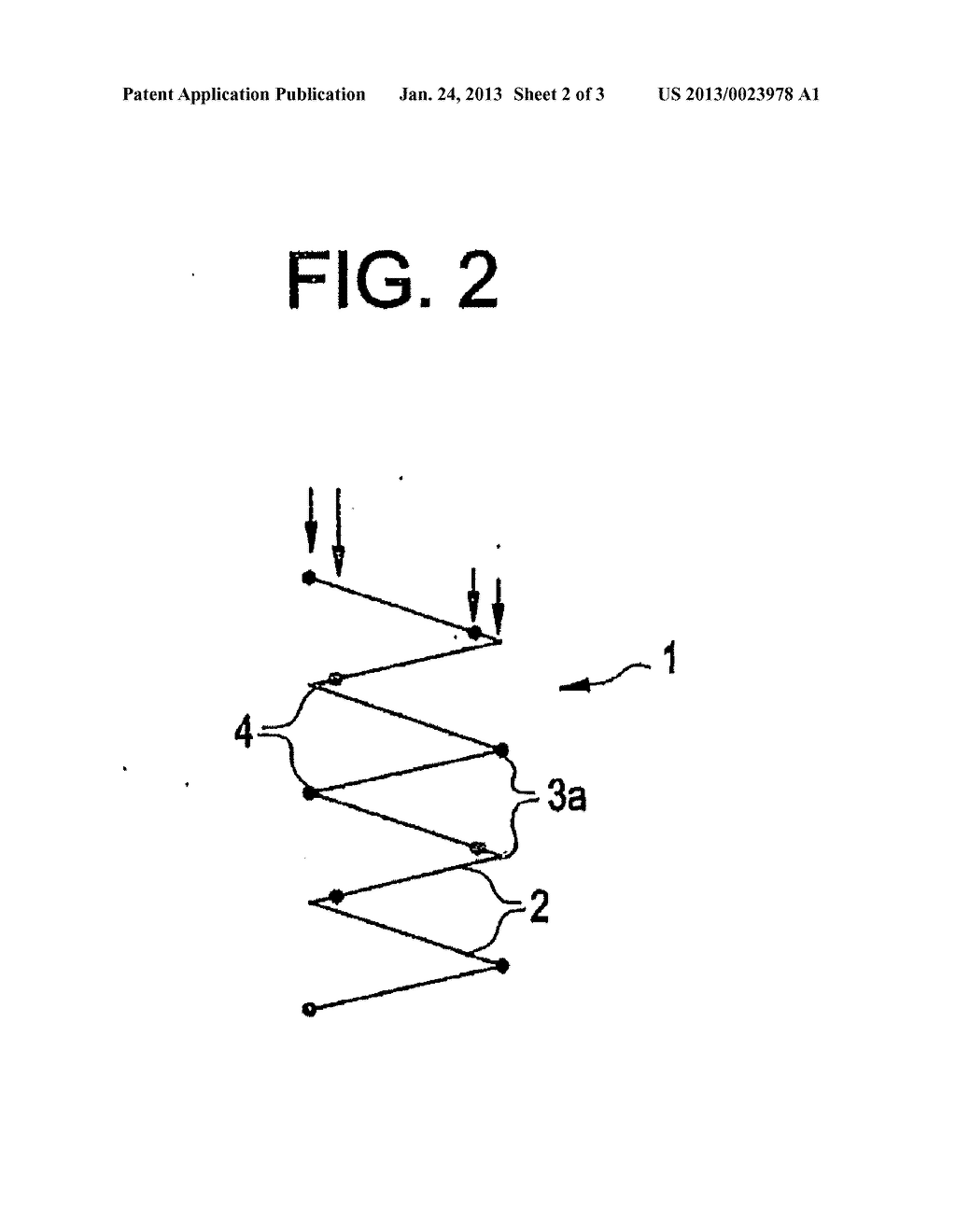 STENT GRAFT DEVICE - diagram, schematic, and image 03