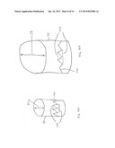 Oval Aortic Valve diagram and image