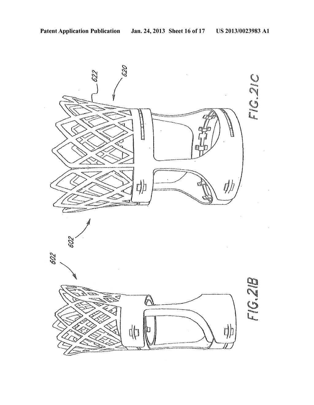 METHOD FOR TREATING AN AORTIC VALVE - diagram, schematic, and image 17