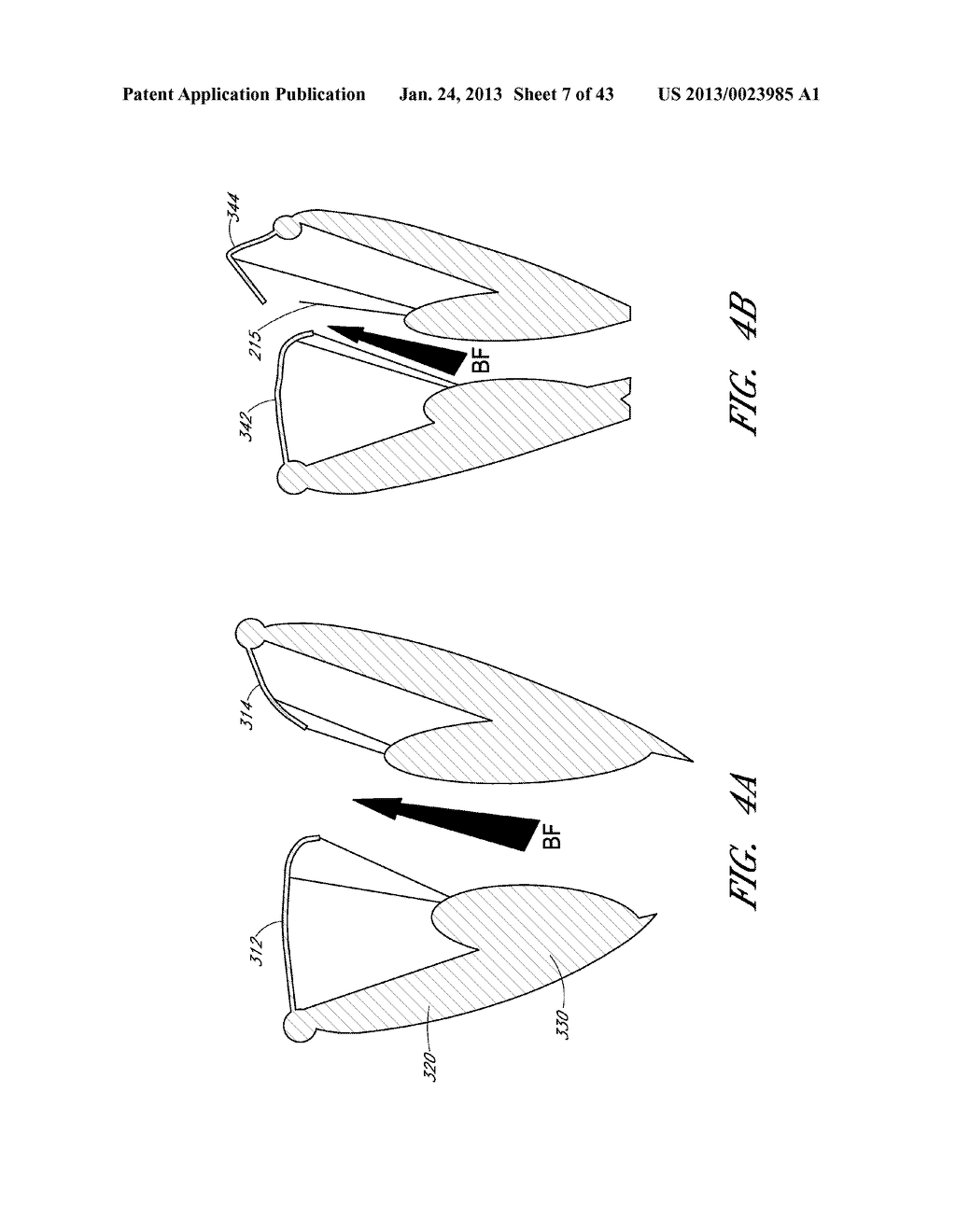 DEVICE, SYSTEM, AND METHOD FOR TRANSCATHETER TREATMENT OF VALVE     REGURGITATION - diagram, schematic, and image 08