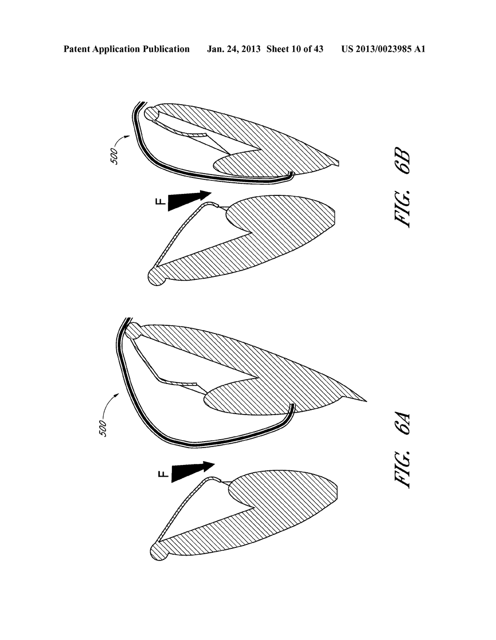 DEVICE, SYSTEM, AND METHOD FOR TRANSCATHETER TREATMENT OF VALVE     REGURGITATION - diagram, schematic, and image 11