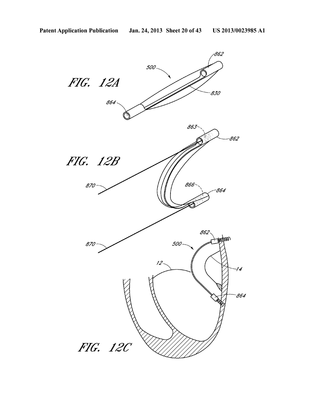 DEVICE, SYSTEM, AND METHOD FOR TRANSCATHETER TREATMENT OF VALVE     REGURGITATION - diagram, schematic, and image 21