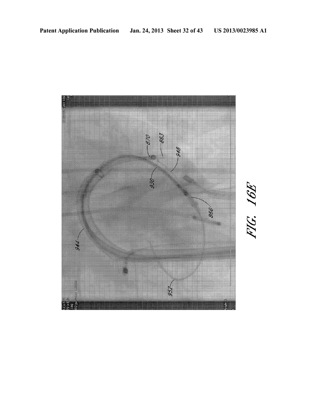 DEVICE, SYSTEM, AND METHOD FOR TRANSCATHETER TREATMENT OF VALVE     REGURGITATION - diagram, schematic, and image 33