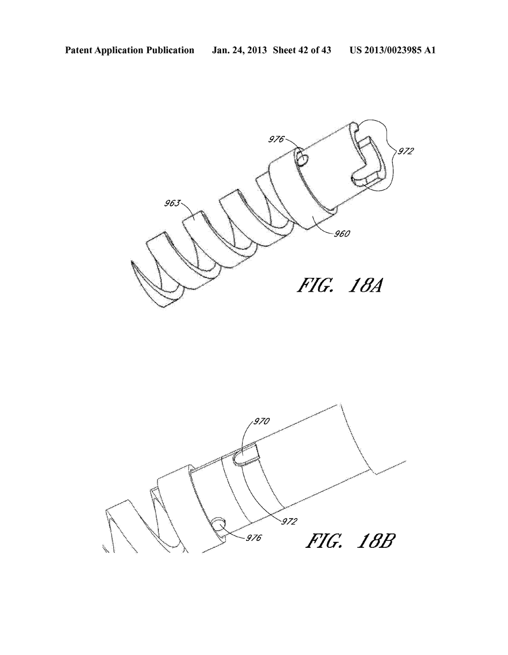 DEVICE, SYSTEM, AND METHOD FOR TRANSCATHETER TREATMENT OF VALVE     REGURGITATION - diagram, schematic, and image 43