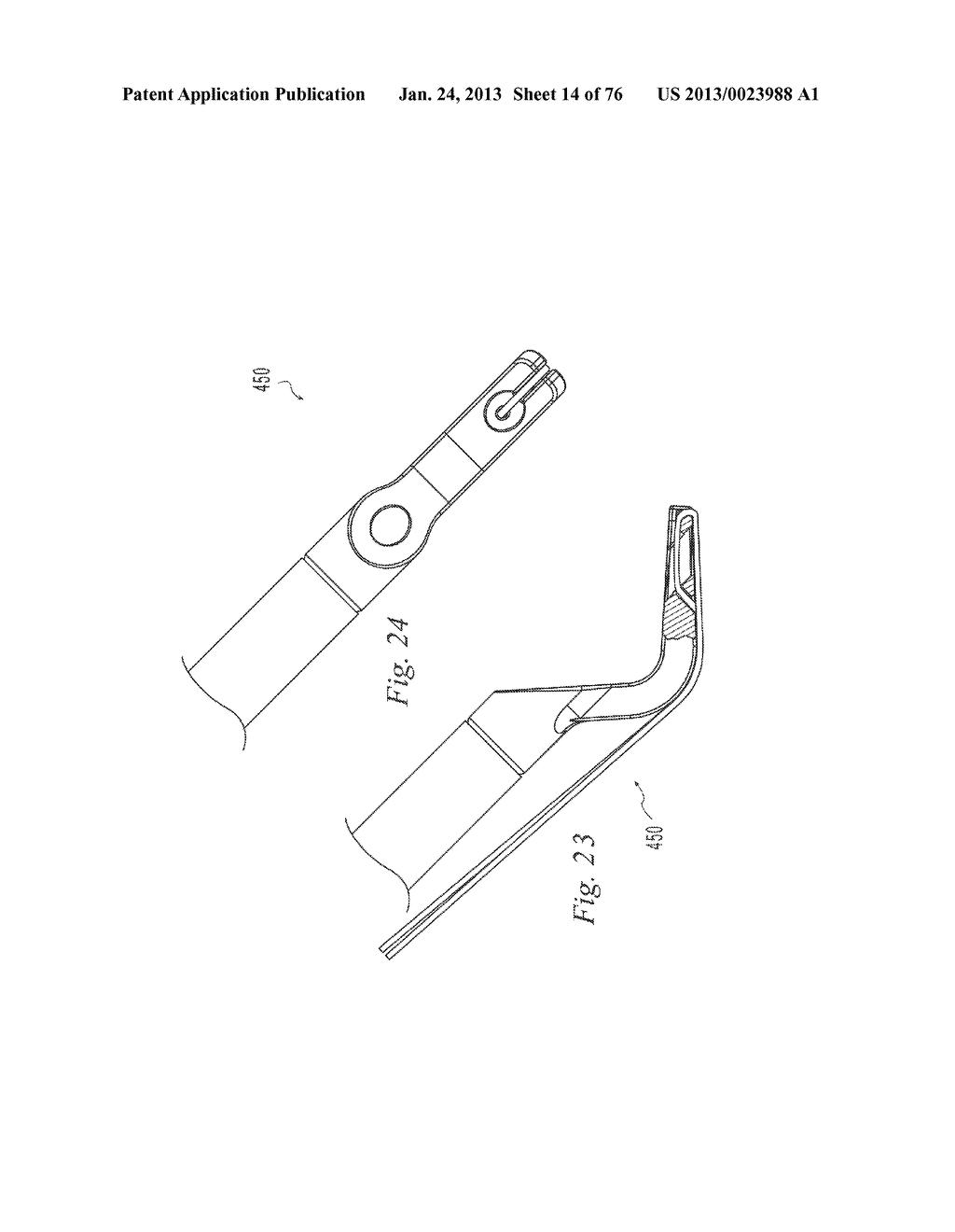 SOFT TISSUE REPAIR - diagram, schematic, and image 15