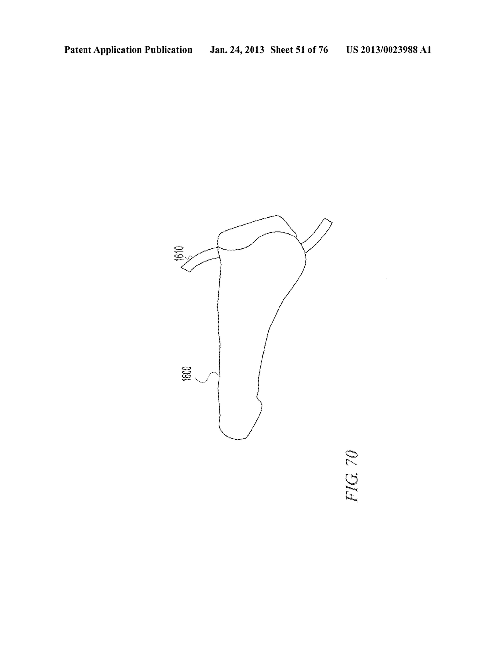 SOFT TISSUE REPAIR - diagram, schematic, and image 52