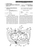 Minimally invasive apparatus to manipulate and revitalize spinal column     disc diagram and image