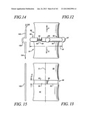 Minimally invasive apparatus to manipulate and revitalize spinal column     disc diagram and image