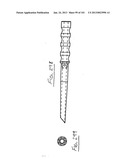 Minimally invasive apparatus to manipulate and revitalize spinal column     disc diagram and image