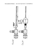 Minimally invasive apparatus to manipulate and revitalize spinal column     disc diagram and image