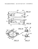 Minimally invasive apparatus to manipulate and revitalize spinal column     disc diagram and image