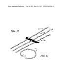 Minimally invasive apparatus to manipulate and revitalize spinal column     disc diagram and image