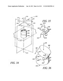 Minimally invasive apparatus to manipulate and revitalize spinal column     disc diagram and image