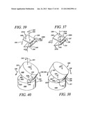 Minimally invasive apparatus to manipulate and revitalize spinal column     disc diagram and image