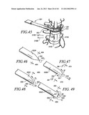 Minimally invasive apparatus to manipulate and revitalize spinal column     disc diagram and image