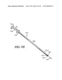 Minimally invasive apparatus to manipulate and revitalize spinal column     disc diagram and image