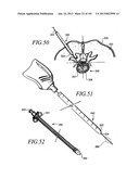 Minimally invasive apparatus to manipulate and revitalize spinal column     disc diagram and image